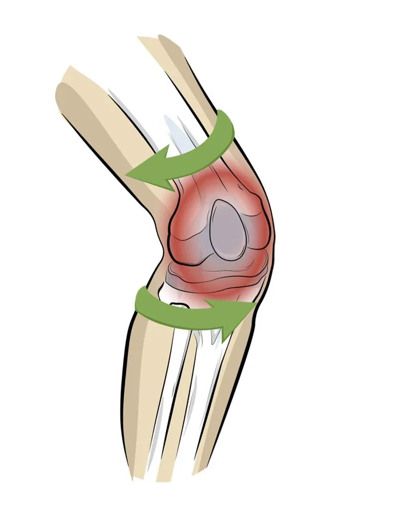 Kniebandage PatellaTec, Größe XXL - 3