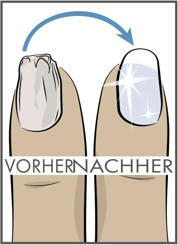 Nagelhärter mit Diamantpulver „Beauty Comfort“, 10 ml - 2