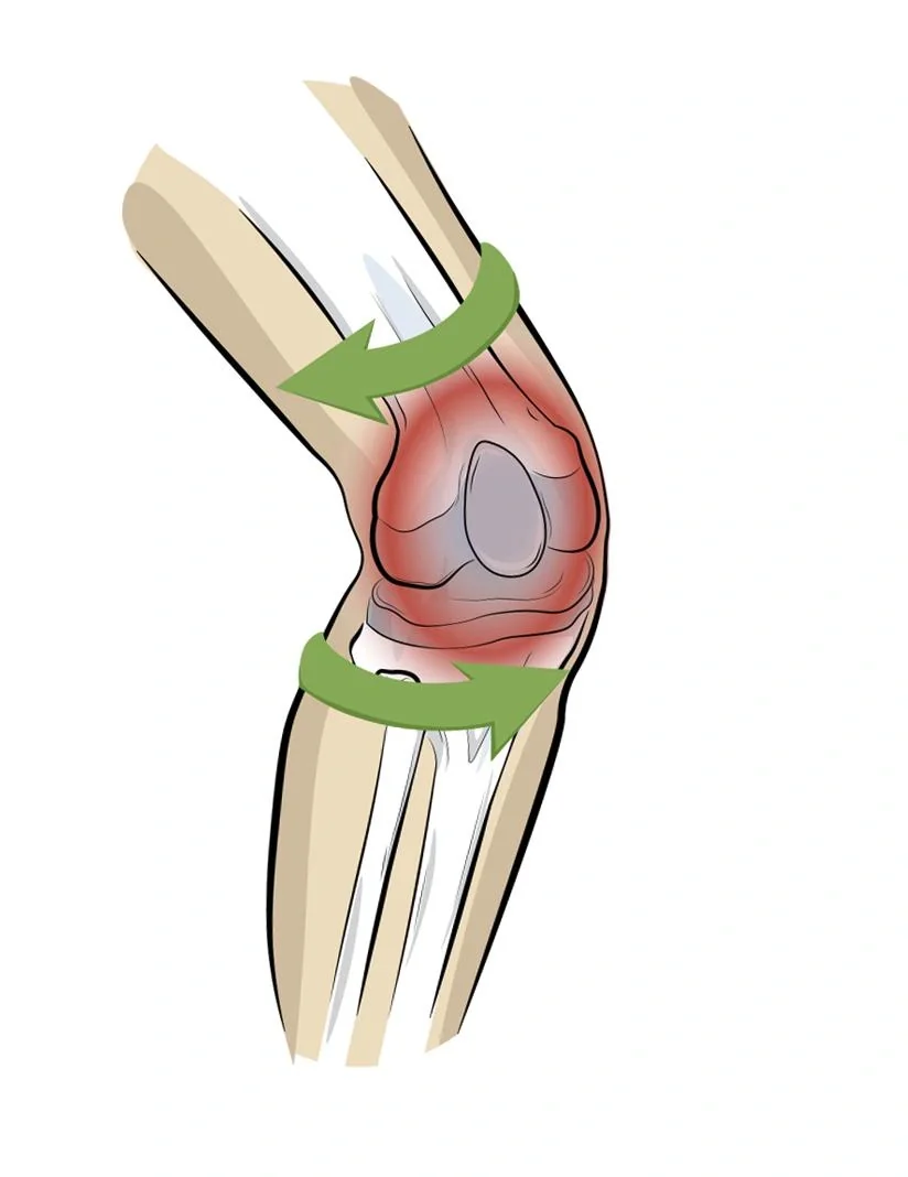 Kniebandage PatellaTec, Größe L - 5